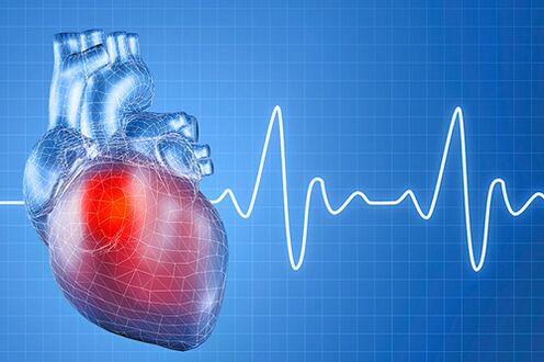 Hypertension, which has multiple causes, causes problems with the functioning of the heart. 